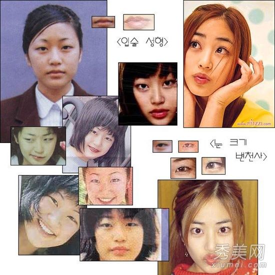 韩国娱乐圈的丑女人来看看谁在整形手术中最成功?