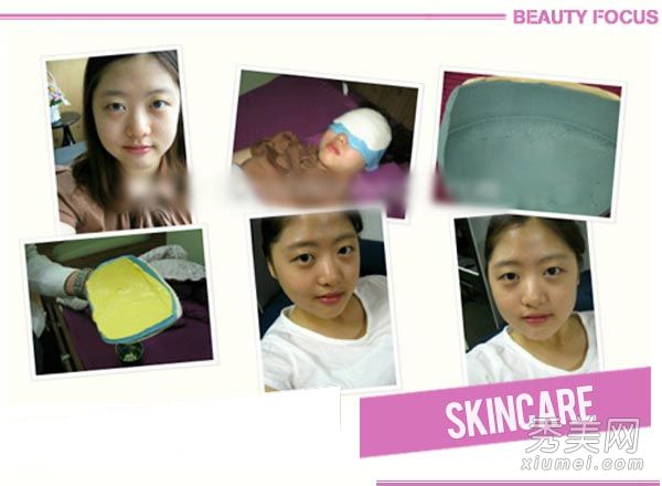 网民去韩国做前额整形+双眼皮+隆鼻