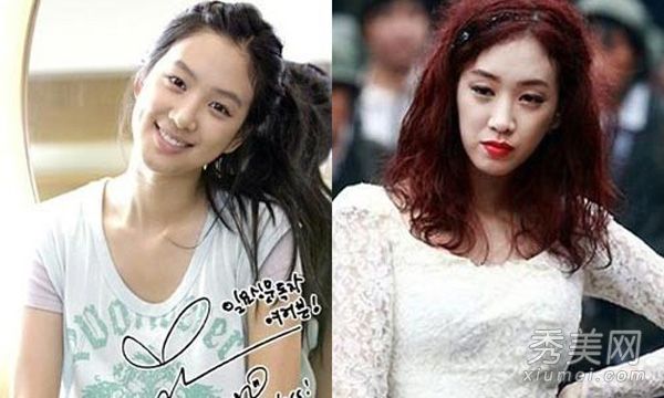 女明星整容失败的明星清单