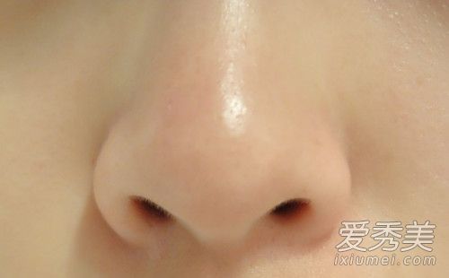 如何最有效地去除黑头？如何防止黑头再生？