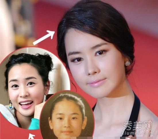李多海换了三次鼻子,韩国女演员整形手术屡遭失败