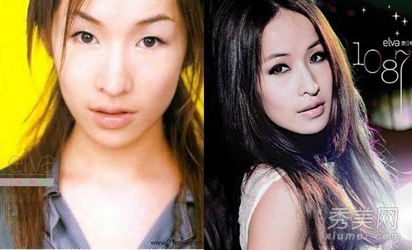 女明星显微手术:七位女明星切双眼皮最成功