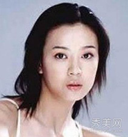 女演员揭示整形手术的原因