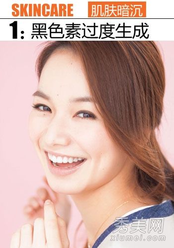 6大皮肤问题使你的皮肤变得暗淡和苍白。