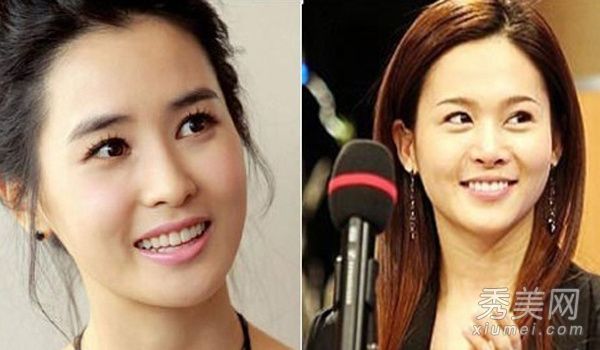 整形外科史上最完整的34组女演员“脸撞”比较(1)