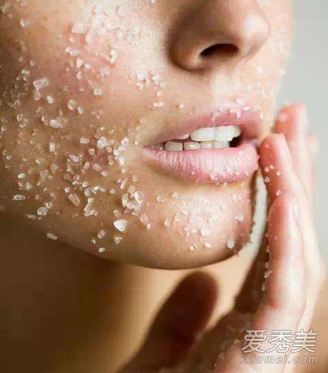 无声痤疮能去角质吗？脸上的粉刺能去角质吗？