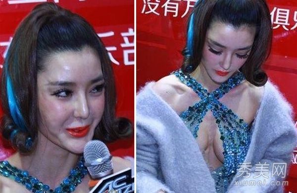 李颖芝和肖强女演员整容失败的惊悚比较