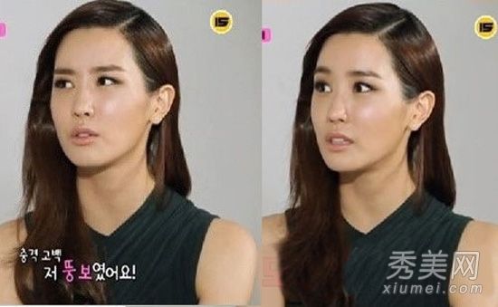 李多海多次承认整容图片卡