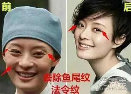 孙莉承认做过整形手术吗?从玉观音到米月传说
