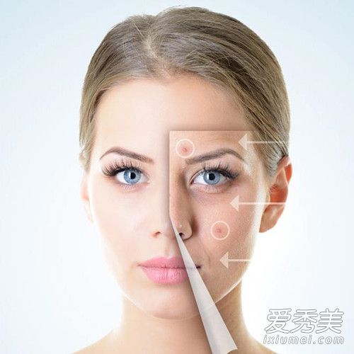 脸上有麻子的你不能吃什么？你吃什么带有天花痕迹的食物？