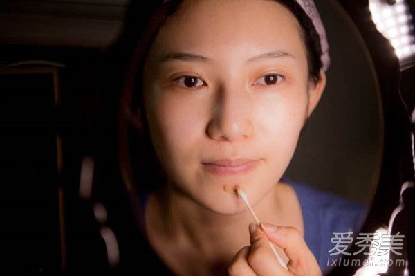 我可以用粉刺来弥补吗？如何弥补天花痕迹？