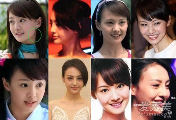 出道6年后，郑爽的脸色变了，下巴又抬起来了。