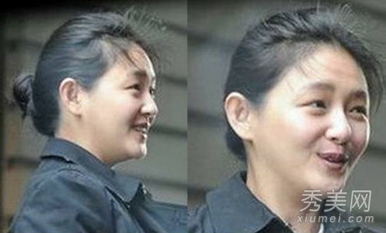 女演员的素面快照大变化脸肿胀脸僵硬