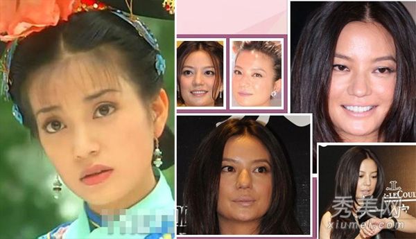 看着赵薇和蔡少芬变老变残疾，真是让人受不了