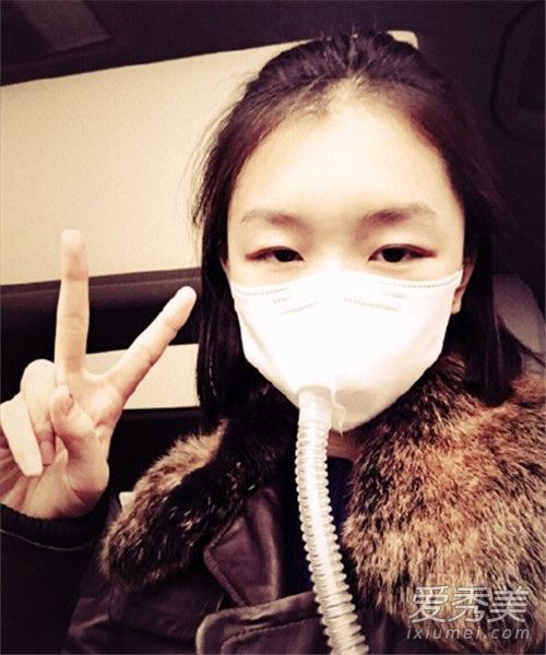 春天如何治疗皮肤过敏？周东宇教你保持柔软和超弹性的肌肉