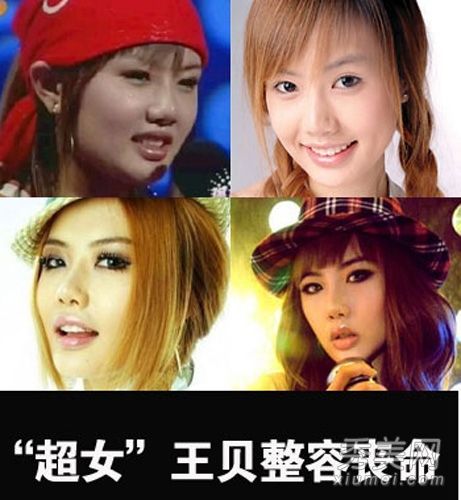 过去，十大美容明星在整形手术后失去生命并毁容。