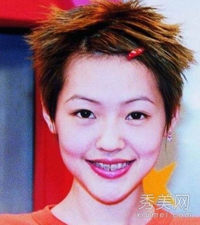 照片显示女演员整容后脸部扭曲