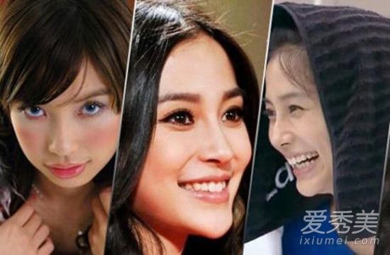 这些女演员的下巴怎么了？