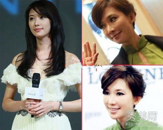 整容后恢复太慢女演员变成“猪脸”