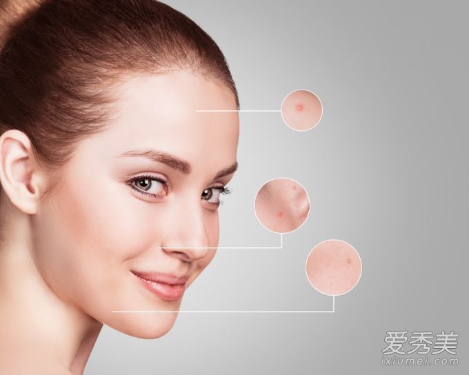 几年前，皮肤清洁解决了皮肤黑暗和疲劳