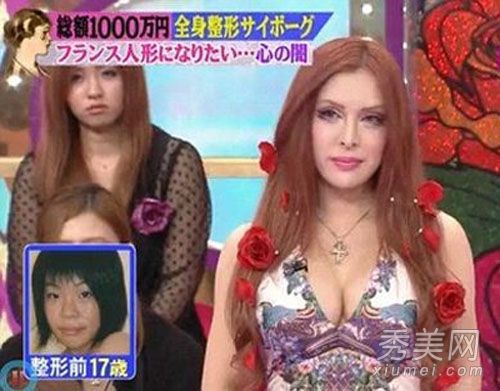 整形手术前后的日本明星:男性割双眼皮+女性隆鼻改变脸型