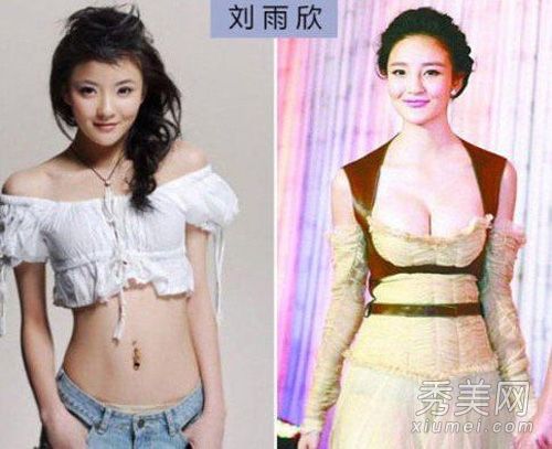 袁姗姗刘师师72变化图揭示明星整形手术部分