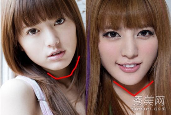 歌手艾伦的整形手术揭露12起狗血事件