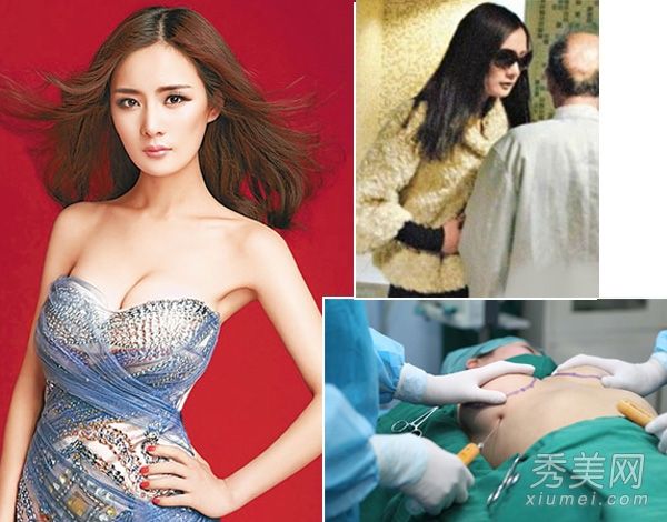 小杨力量在隆胸中大受欢迎13位女明星整容