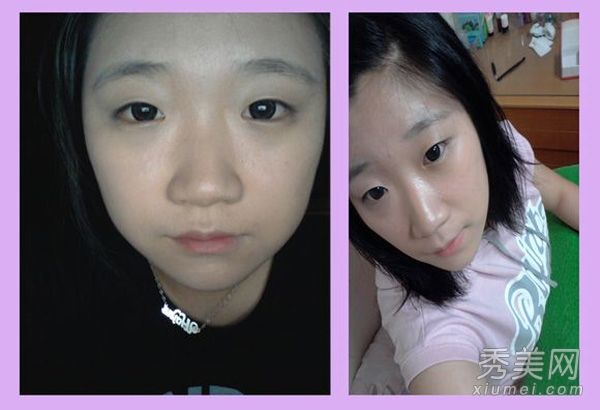 整容经验:图揭示互联网用户的整容改造历史