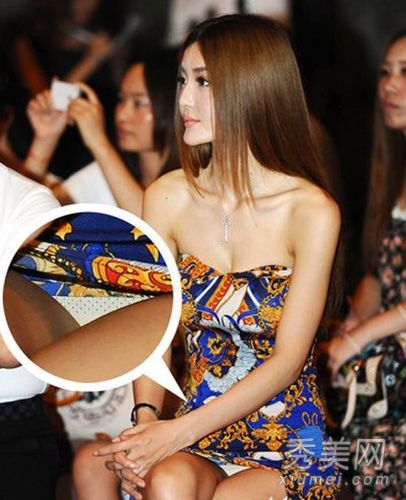 汽车模型李颖芝下巴变形疑似整形手术失败后遗症加剧