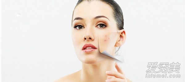 当痤疮快速增长时,停止这些行为并开出正确的药物是最好的政策。