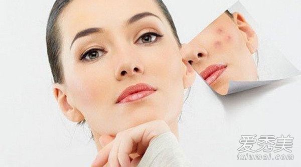 全年必须避免的四大痘危机