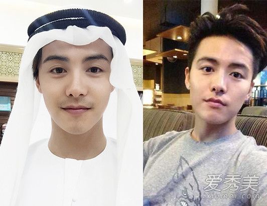 整形手术失败案例:孙健整形手术撞脸与马天宇“返工”