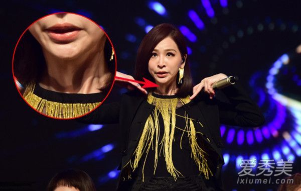 王心凌的脸肿了吗？面部表情僵硬，脖子上的线条爆了出来。