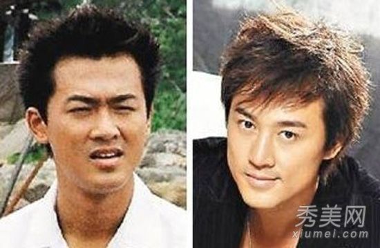 尹恩惠，林雷蒙德，隆鼻，变脸和职业提升