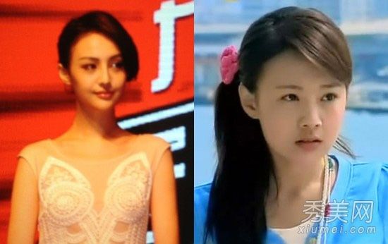 娱乐圈的“变脸”女演员整容前后反差很大