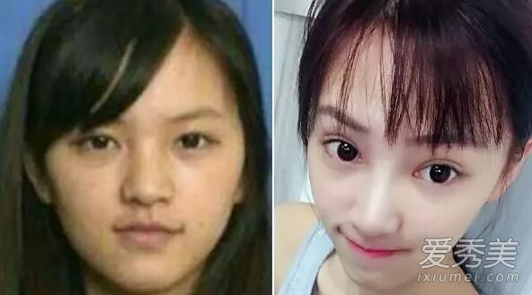 如何粘贴“隐形”双眼皮贴(步骤图)