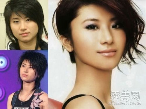 女明星拔牙后有瘦脸吗?有照片证明吗?