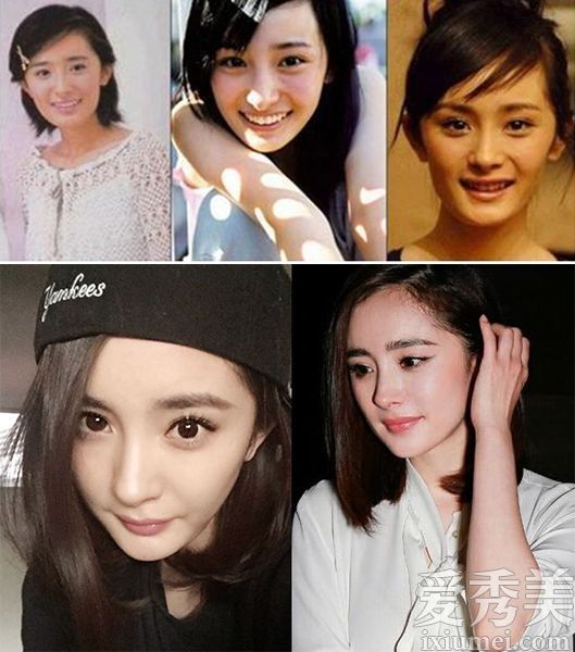 十大最成功整形手术案例:当地村民成为白人和富有的女神