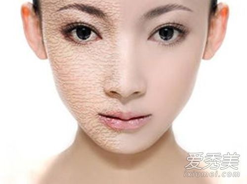 你在冬天有干燥和肿胀的皮肤吗？这些小贴士明天会变得顺滑而温柔