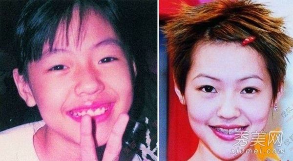 娱乐圈后天美人小林心如修牙前的恐惧比较