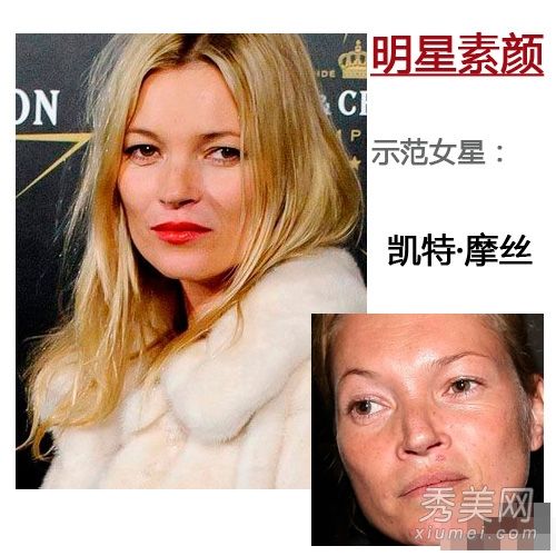 有痘痘和雀斑的欧美女演员令人恐惧