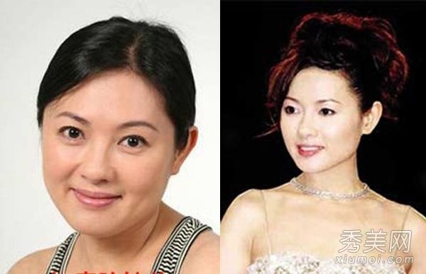 李丽珍大明星王菲用骨针整容前后十大女演员