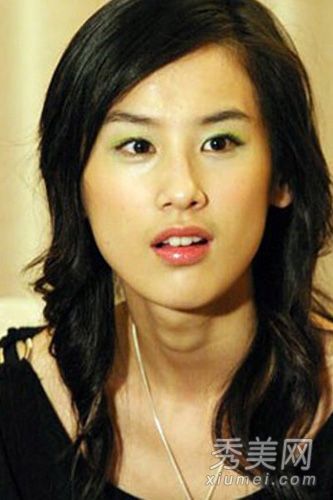 暴露女演员脸上的硬伤和整形手术救不了