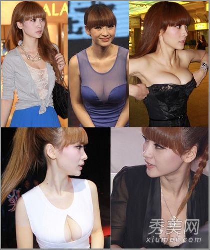 整形外科领域最成功的女明星:隆胸+切骨