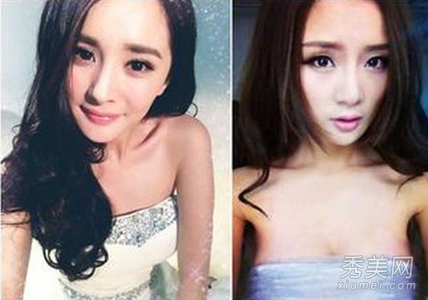 模特李丹美胸肖像隆胸整形手术PK杨蜜