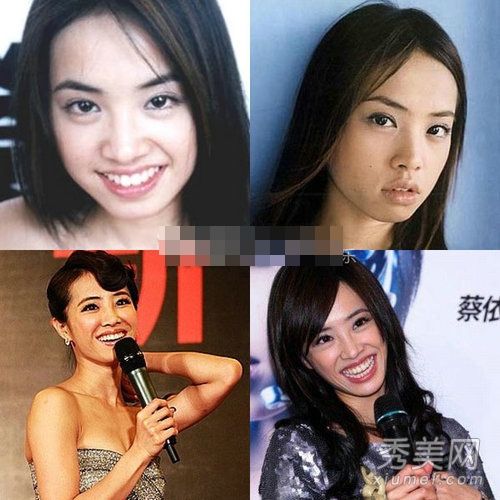 27“整容”女演员闫星整容失败后变成面瘫(2)