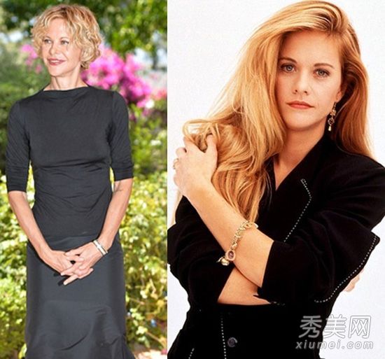 隆唇手术:好莱坞过期后整容手术失败,隆唇变形