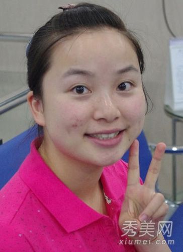 网友体验“软化激光”医学美容(照片)
