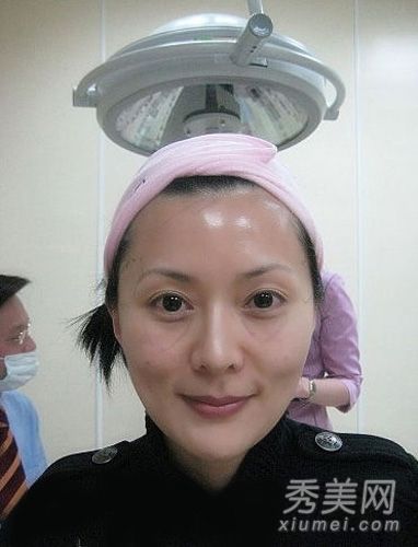 陈丽敏，一个40岁的香港明星，已经做了30次整形手术，并在美国白针队失去了生命